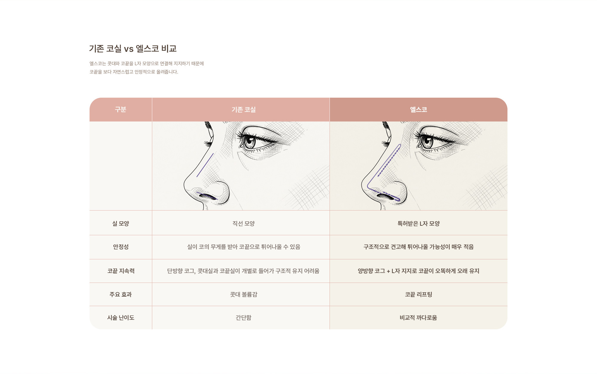 [기존 코실 vs 엘스코 비교] 엘스코는 콧대와 코끝을 L자 모양으로 연결해 지지하기 때문에 코끝을 보다 자연스럽고 안정적으로 올려줍니다.