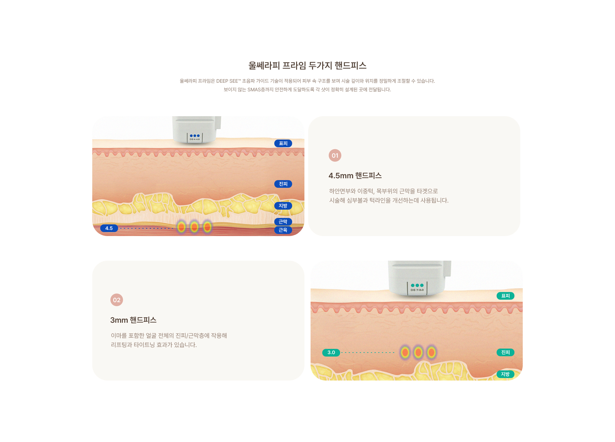 [울쎄라 두가지 핸드피스] (01) 4.5mm 핸드피스 : 하안면부와 이중턱, 목부위의 근막을 타겟으로 시술해 심부볼과 턱라인을 개선하는데 사용됩니다. (02) 3mm 핸드피스 : 이마를 포함한 얼굴 전체의 진피/근막층에 작용해 리프팅과 타이트닝 효과가 있습니다.